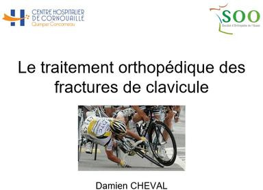 CONTROVERSE MEMBRE SUPERIEUR