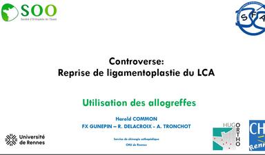 CONTROVERSE REPRISE DE LCAE : ALLOGREFFE vs RESTUS FEMORIS