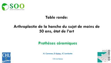 Arthroplastie totale de la hanche du sujet de moins de 50 ans, état de l'art