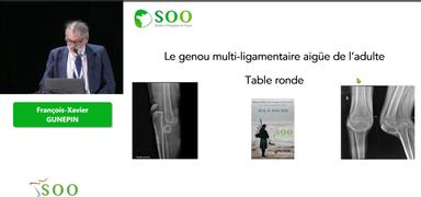 Le genou multiligamentaire aiguë chez l'adulte