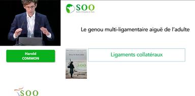 Le genou multiligamentaire aiguë chez l'adulte : reconstruction, ligaments collatéraux