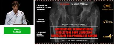 Résultats de l'intervention de Girdlestone pour le traitement de l'infection réfractaire sur PH