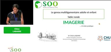 Le genou multiligamentaire aiguë chez l'adulte