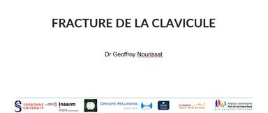 CONTROVERSE MEMBRE SUPERIEUR