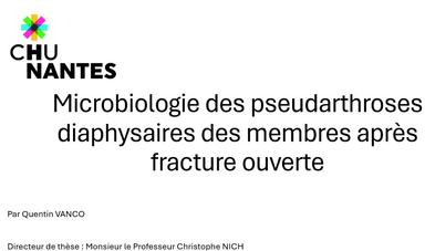 CONCOURS THESE EN 180 SECONDES