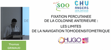 Fixation percutanée de la colonne antérieure : les limites de la navigation tomodensitométrique